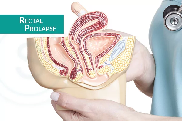 Homeopathic solutions for Gastro intestinal disorders